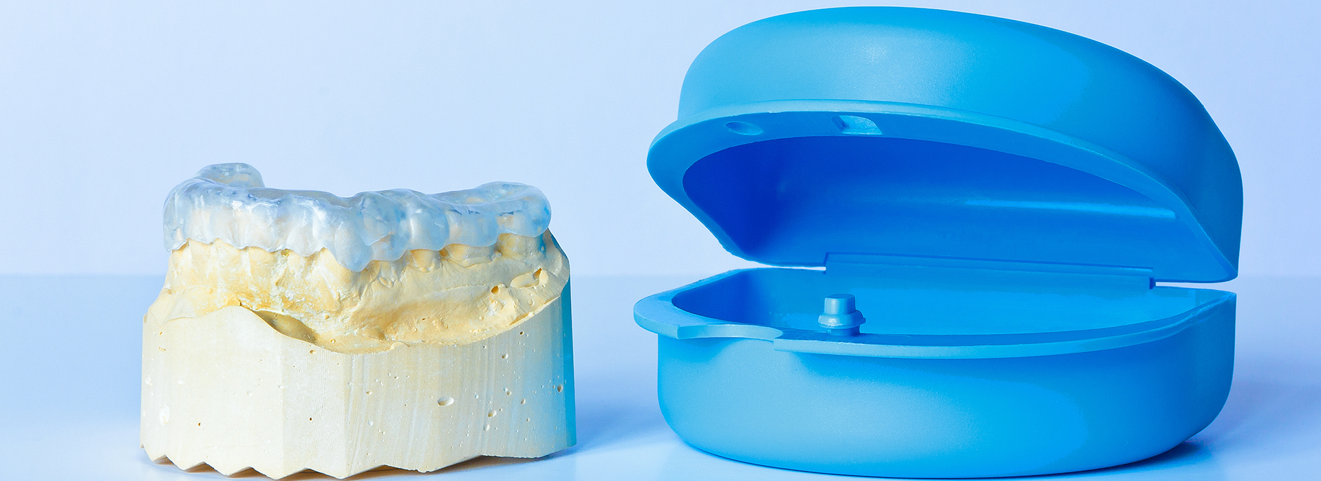 An image showing a tooth model and a dental implant, likely used for educational or demonstration purposes.