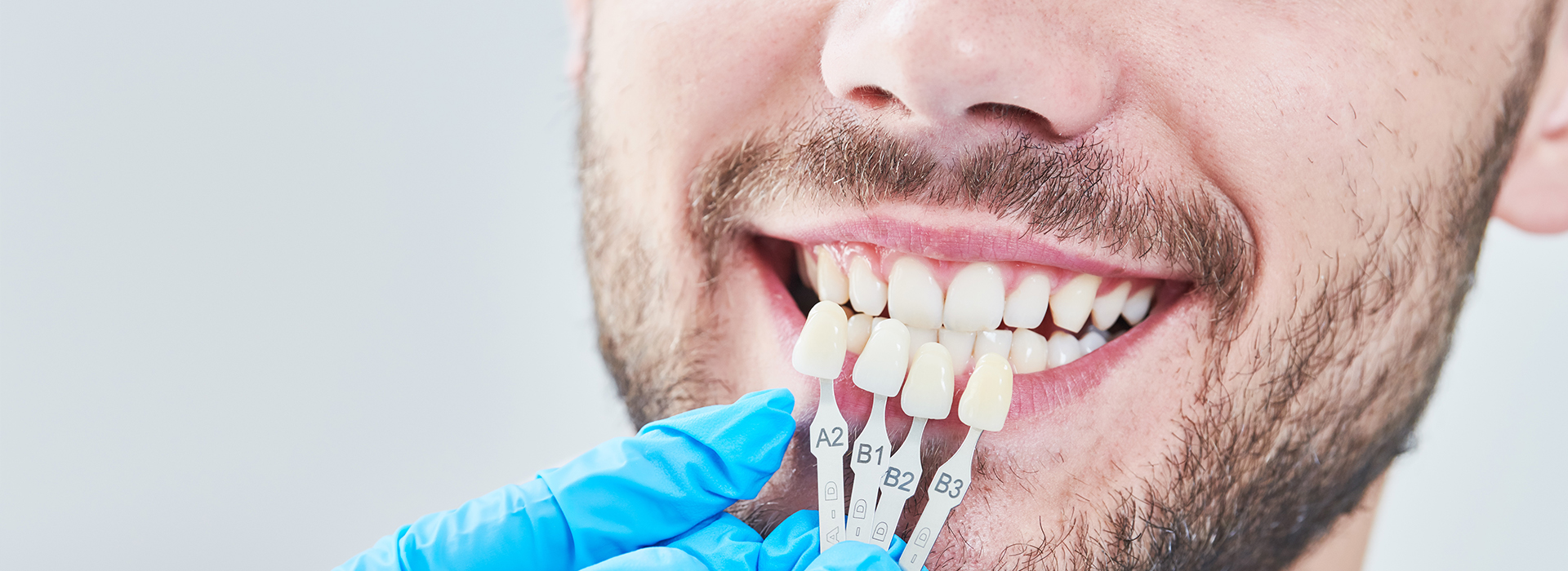 A man undergoing dental treatment, with a tooth being prepared for a crown, set against a white background.